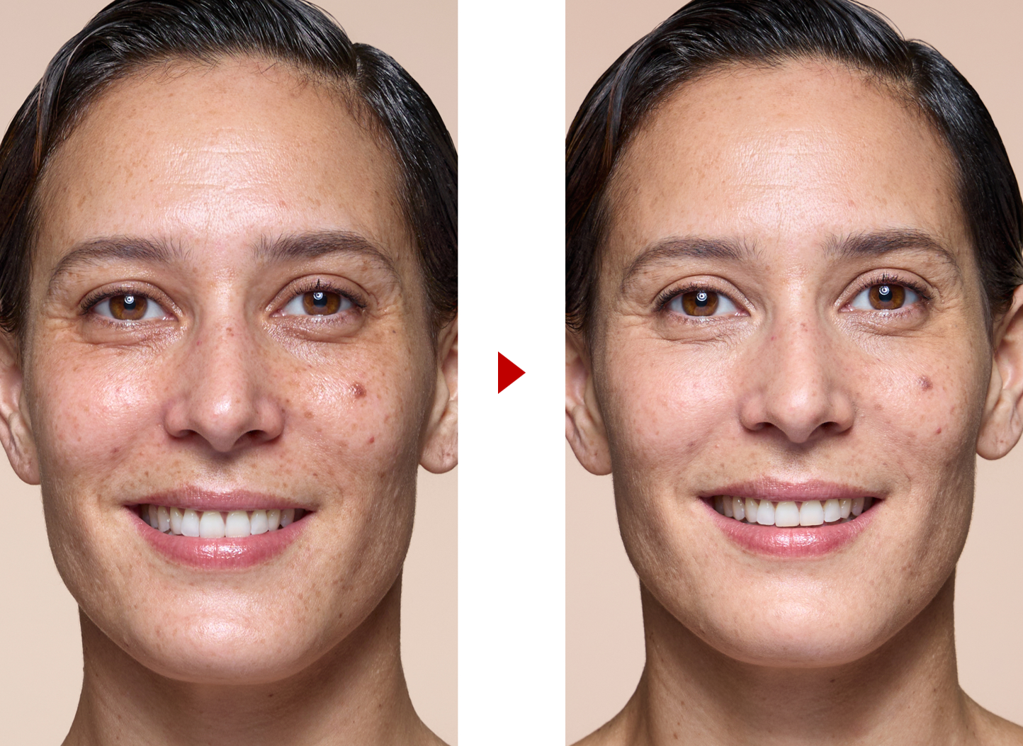 résultats avant après maquillage teint terne