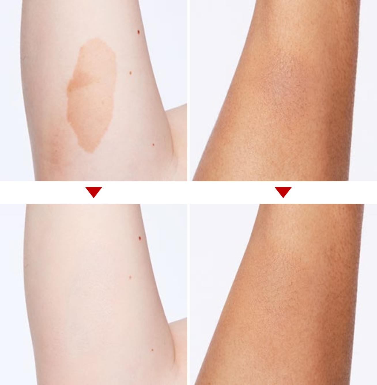 résultats avant après maquillage taches brunes